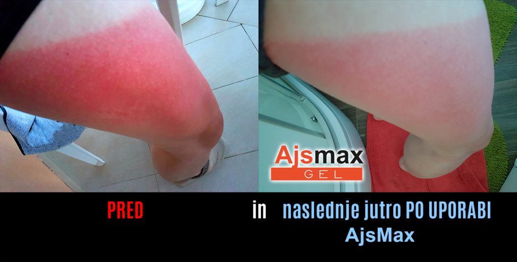 Praktični prikaz rezultat delovanja AjsMax gela